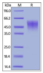 Mouse IL-2 R alpha, His Tag on SDS-PAGE under reducing (R) condition. The gel was stained overnight with Coomassie Blue. The purity of the protein is greater than 90%.